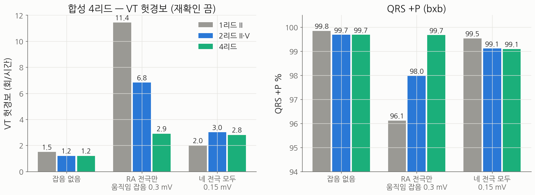 합성 4리드 전극 잡음 결과