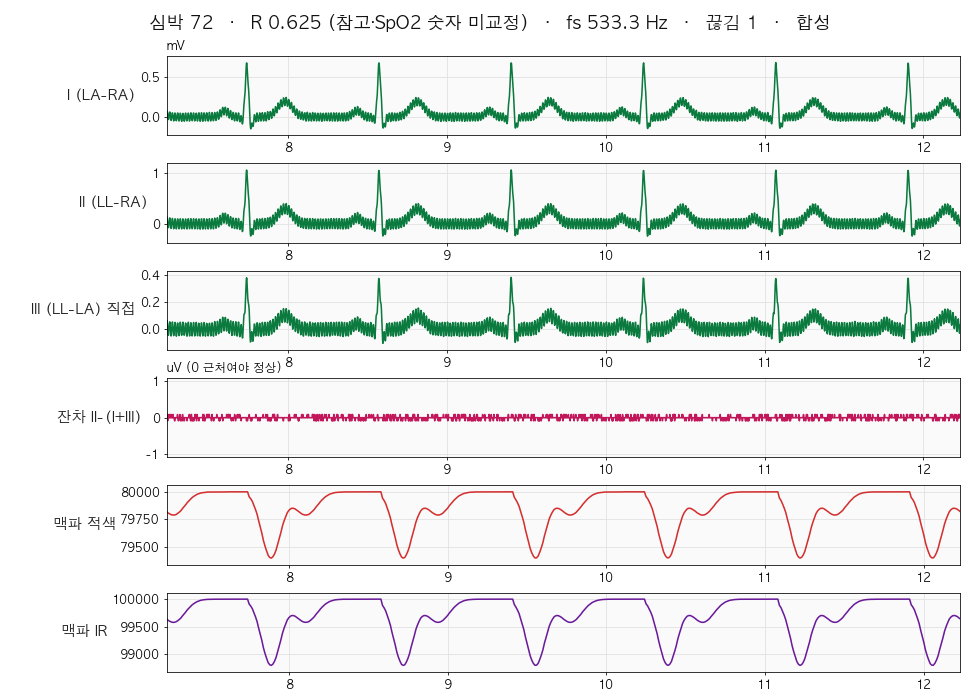 합성 신호 재생 수신 화면: lead I, II, III, 잔차, 맥파 적색, 맥파 IR 6줄